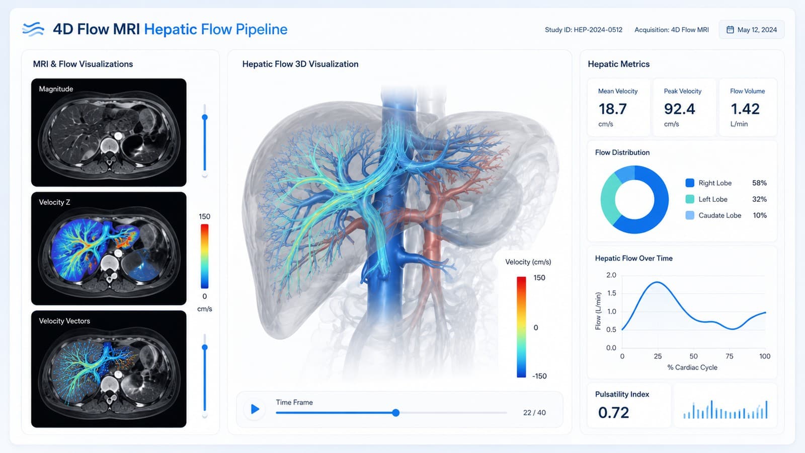 Hepatic flow pipeline concept visualization showing 4D Flow MRI slices and a 3D vascular flow render