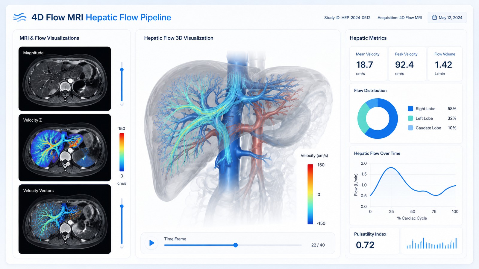 Hepatic flow pipeline concept visualization showing 4D Flow MRI slices and a 3D vascular flow render